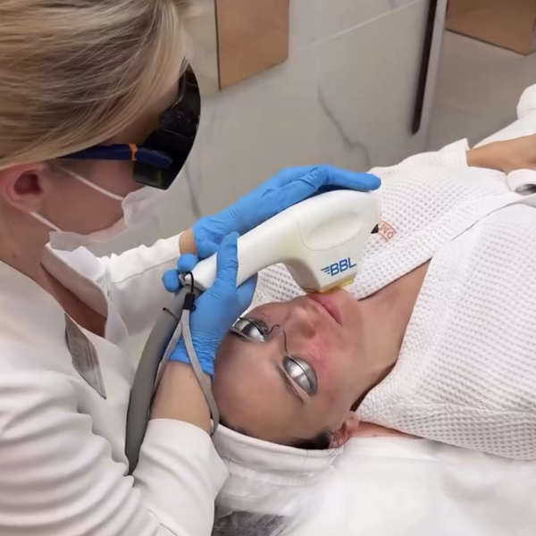 Экс-солистка SEREBRO показала лицо без макияжа и фильтров